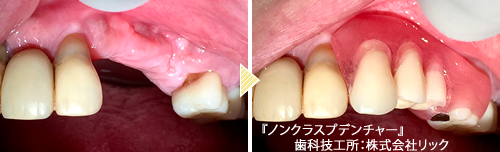 大阪市梅田の歯医者 歯科医院 できるだけ痛くない無痛治療 梅新デンタルクリニック